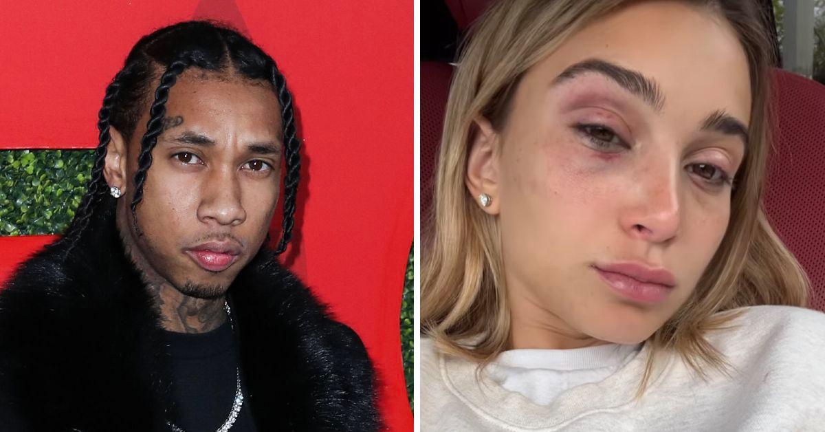 tyga camaryn swanson disneyland domestic violence arrest black eye