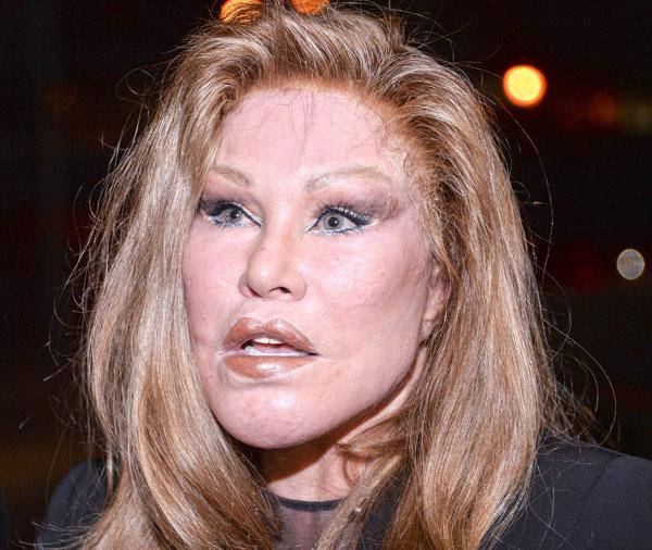 Jocelyn Wildenstein Plastic Surgery Photos