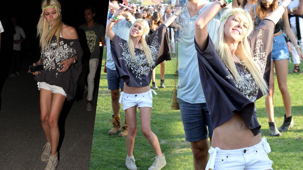 Tara Reid Scary Skinny Coachella​ 2015