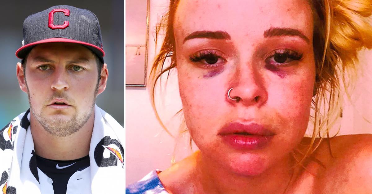 trevor bauer sexual assault accuser nurse testimony injuries alarming restraining order r