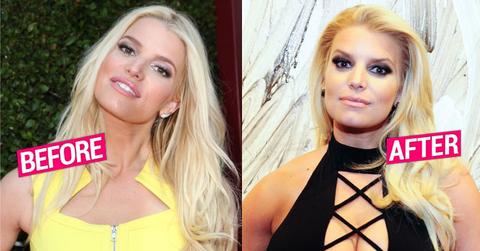 //jessica simpson breast enhancement plastic surgery