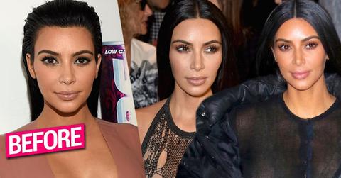 //Kim Kardashian NYFW Plastic Survery Cheeks