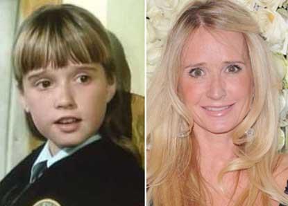 //kim richards child star plastic surgery