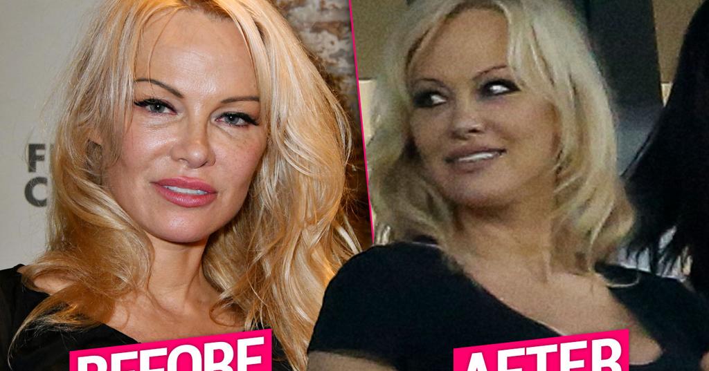 Pamela Anderson Plastic Surgery Makeover Top Docs Tel All Pamela Anderson Plastic Surgery Makeover Top Docs Tel All