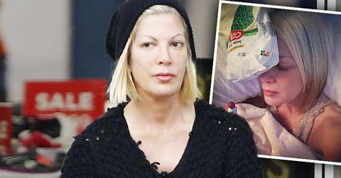 Tori Spelling hospitalized Migrane