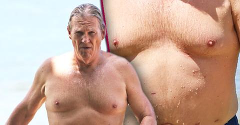 jeff bridges surger scars actor undergoes hernia operation