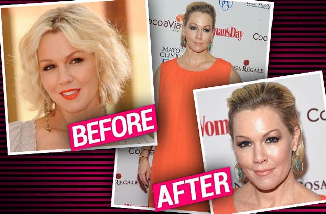 //jennie garth plastic surgery botox red carpet pp