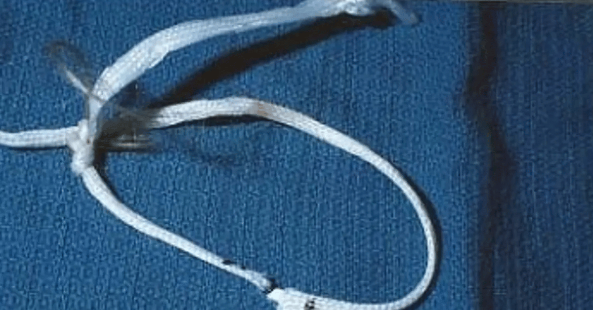 Photo of garrote used on JonBenét.