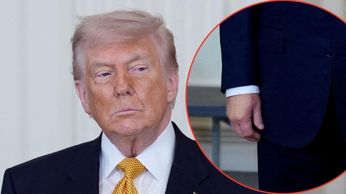Donald Trump was spotted with makeup slathered on his hands at a White House event.