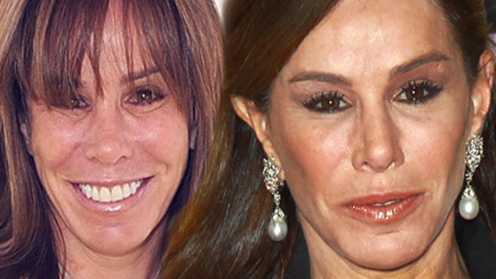 //Melissa Rivers face pp