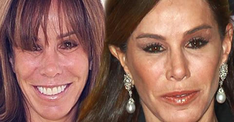 //Melissa Rivers face pp